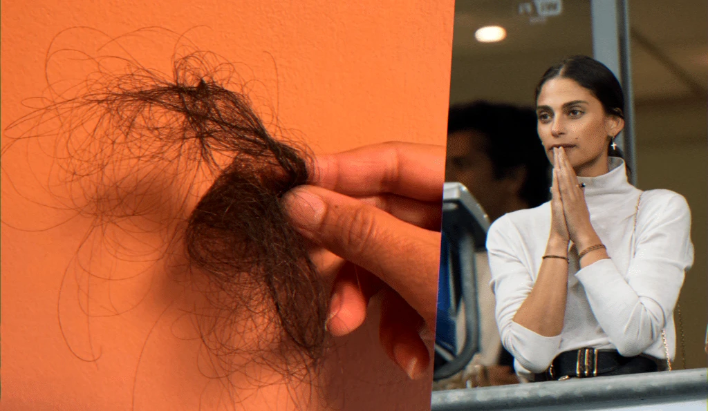 témoignage perte de cheveux post-partum six mois après la naissance