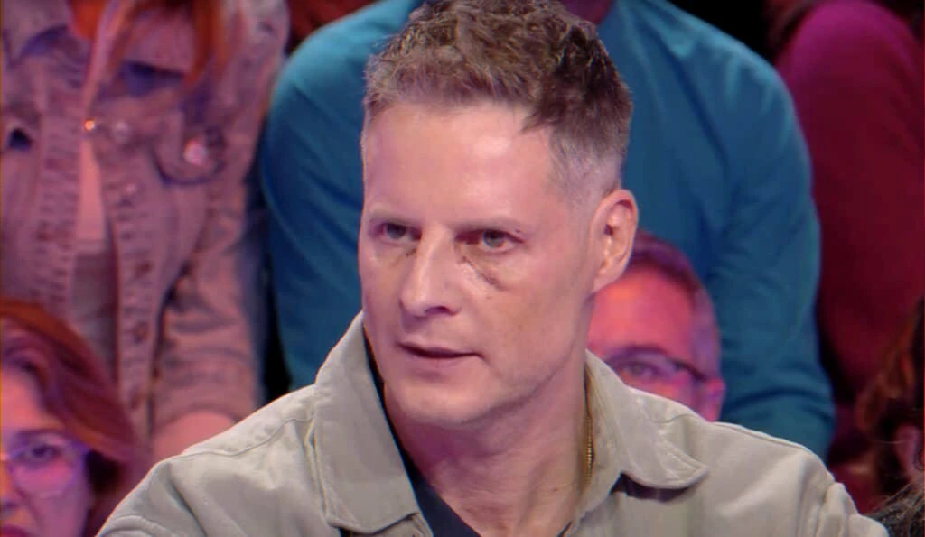 on-air explanations after reported head injury and ensuing public doubts