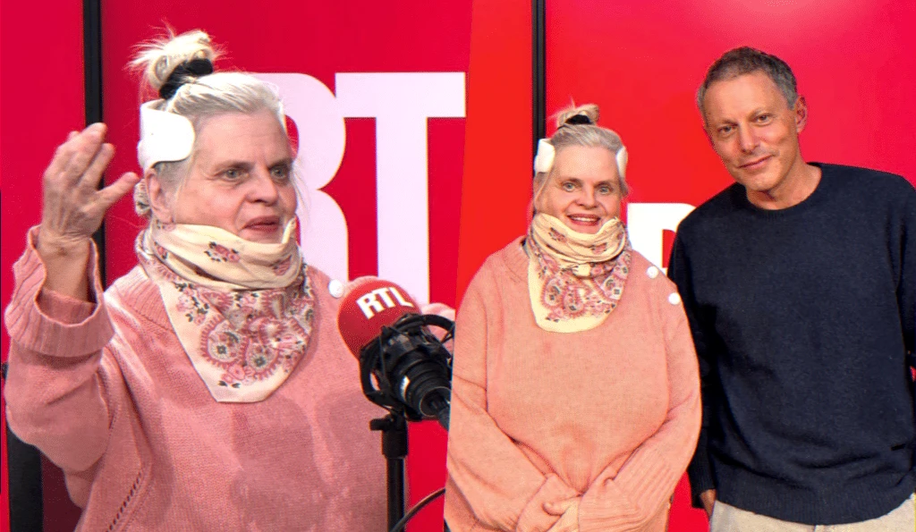 actress recovery after road accident — rehabilitation and gradual return to the stage