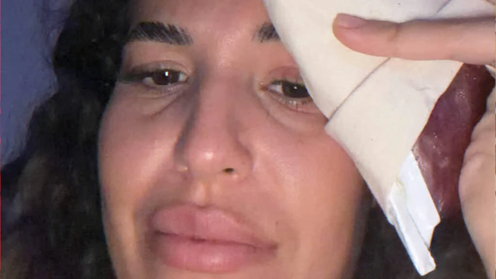 Influenceuse blessée à l'arcade lors de la finale CAN à Rabat — photo Instagram supprimée