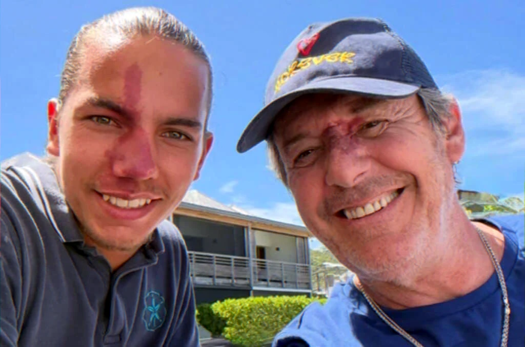 longstanding-friendship-reunion-support-angioma