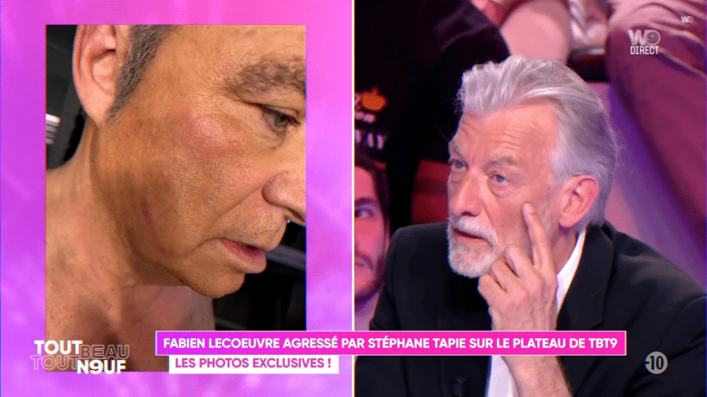 on-set altercation leads to hospitalization and injury photos